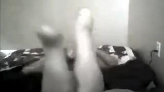 Amputee