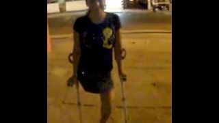 amputee4