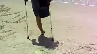 One Legged Stump amputee