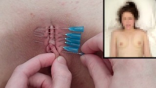 Bf Piercing Her Pussy Shut W Needles Bolestivé Bdsm Šití Šité