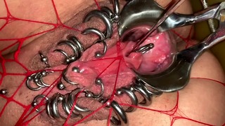 Sounding Sletje and Semen Extreme