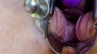 Gynecological Retractor! Stretching Pussy And Fucking Myself With A Dildo! Trailer