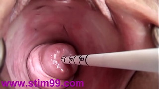 Fuck My Cervix - Extreme Real Cervix Fucking Insertion Japanese Sounds And Objects In Uterus  - Darknessporn.com