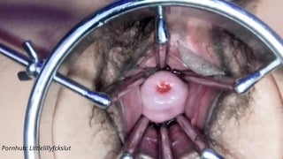 First Insertion: The Extremity Dildo. Spreader Pussy Held Wide Open. Cervix Showing. Speculum.