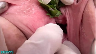 Ortigas en la mirilla Inserción uretral Ortigas y coño con puño
