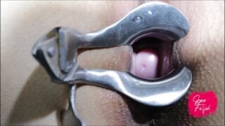 3 Different Speculums – Gyno Fetish