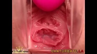 Gyno Cam Close-Up Vagina Cervix Siswet19 — My Chat