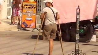 Amputee