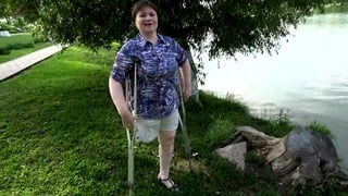Amputee Fetish Fixation