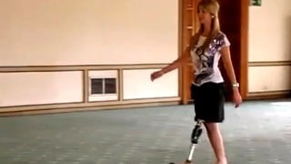 Amputee Prosthetic Kink
