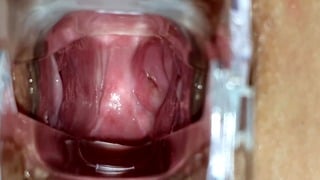 Couple Lesbian Medical Hot